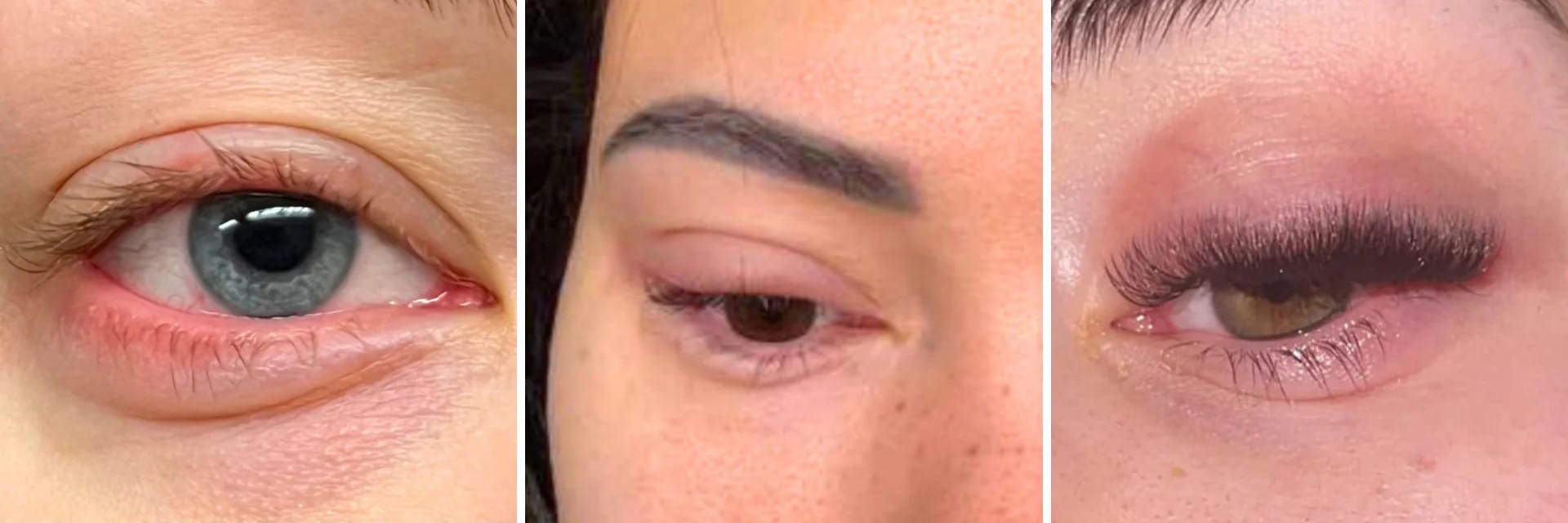 allergic to eyelash glues